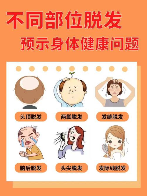 献出秀发传递爱心，助力因病脱发者重拾信心及活动细节