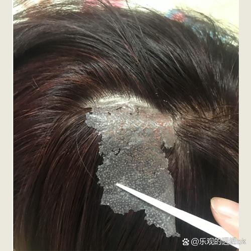 捐献头发的意义：助脱发群体重拾信心，献善心让发丝更有价值